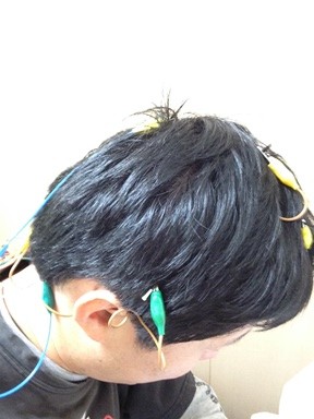 「東洋医学」を代表する治療法「鍼」　/  acupuncture – the major treatment of Oriental medicine